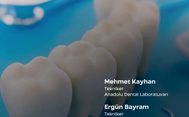 Special Techniques in Porcelain Prosthetics